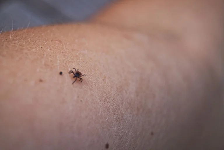 Lietuvoje erkės aktyvios ir rudenį: skiepytis dar ne vėlu